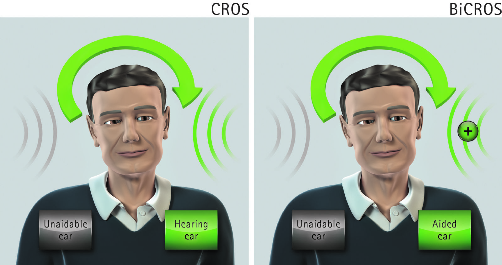 CROS / BI-CROS ακουστικά βαρηκοΐας